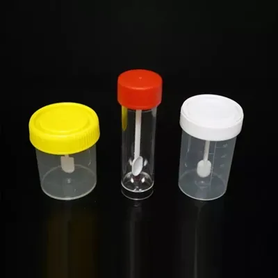 Features To Look For in Fecal Collection Containers